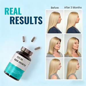 Píldoras de Biotina, Queratina <span class=keywords><strong>y</strong></span> Colágeno de Primera Calidad, Marca Privada, Suplemento Herbal <span class=keywords><strong>para</strong></span> la Salud de Adultos, Promueve el Crecimiento del <span class=keywords><strong>Cabello</strong></span>, la Piel <span class=keywords><strong>y</strong></span> las <span class=keywords><strong>Uñas</strong></span> - Product Image 4