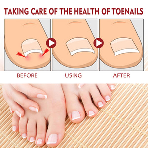 Esencia para el Cuidado de los Pies con Hongos, Gel para Eliminar Hongos de los Dedos de los Pies, Aceite para el Cuidado Anti-Infecciones - Product Image 6