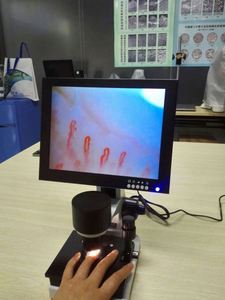 Nail Fold Blood Test <span class=keywords><strong>Digital</strong></span> Biológico Capilar Verificação Microcirculação Checkup Microscópio - Product Image 3