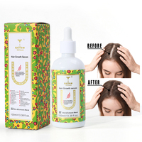 Huile de romarin naturelle personnalisée de marque privée nourrit le traitement de la perte de cheveux du cuir chevelu sérum à la biotine pour la croissance des cheveux