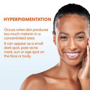 Crema Anti-Manchas con Niacinamida, Sin Hidroquinona ni Parabenos, Probada Dermatológicamente para Todo Tipo de Piel, Elimina Manchas Oscuras - Product Image 2