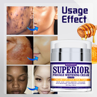 Crème éclaircissante pour le visage Superior Freckle 4K Plus pour femmes, alpha-arbutine et acide kojique avec collagène pour éliminer les taches brunes