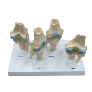 Modèle de genou pour l'arthrite, modèle des articulations du genou à 4 étages - Product Image 1
