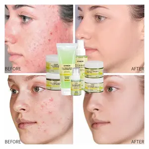 Private Label Organic Skin Care Set Tea Tree Face Cream Remove Anti Acne Shrink Pores Tea Tree Skin Care Beauty Face Gift Set