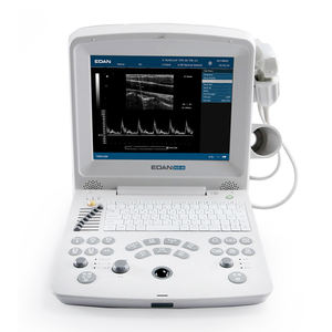 Mesin <span class=keywords><strong>Ultrasound</strong></span> <span class=keywords><strong>Edan</strong></span> DUS-60 Laptop Mesin <span class=keywords><strong>Ultrasound</strong></span> Portabel <span class=keywords><strong>Edan</strong></span> - Product Image 3