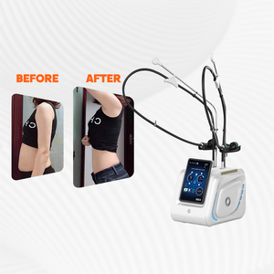 Máquina de Belleza Profesional de Alta Calidad para Quemar Grasa, Lifting Facial, Moldeado Corporal, Coolwave, Lifting de Piel - Product Image 1