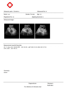 Mesin pemindai <span class=keywords><strong>Ultrasound</strong></span> Keyboard penuh, peningkatan baru diagnostik gema Notebook Digital B - Product Image 6