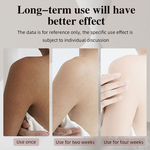 Bán Buôn 5 Trong <span class=keywords><strong>1</strong></span> Vitamin C E Niacinamide Làm Sạch Sâu Hữu Cơ Cơ Cơ Thể Tắm Khuôn Mặt Glow Sáng Mụn Trứng Cá Handmade Làm Trắng Xà Phòng - Product Image 4