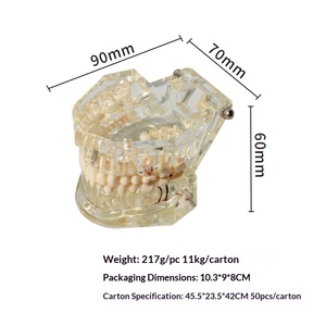 Tandheelkundig model voor het onderwijzen van patiënt-doctorcommunicatie, tandheelkundige afdrukvorm, transparant, afneembaar implantaat voor kinderen - Product Image 2