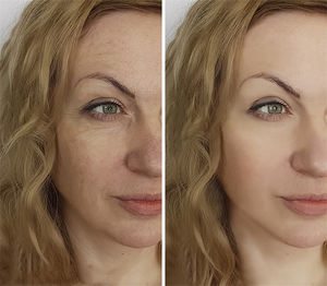 ราคาโรงงานขายส่ง OEM ผลิตภัณฑ์บำรุงผิวหน้า แคปซูลฟูลเลอรีน เอสเซนส์บำรุงผิวหน้า ช่วยลดเลือนริ้วรอยและต่อต้านวัย - Product Image 6