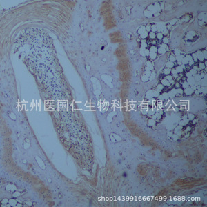 Immunohistochemistry Tissue Sample Pathology Service Paraffin Sections Cell Slides Frozen Sections Biotechnology Lab Reports - Product Image 4