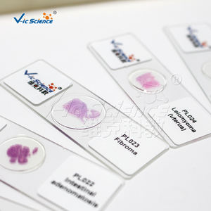 Lames de Pathologie Médicale Humaine 50 pièces, Lames de Pathologie Vétérinaire, <span class=keywords><strong>Papillome</strong></span> Cutané, Lames de Pathologie Médicale - Product Image 4
