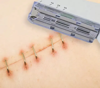 Agrafeuse clinique de chirurgie vétérinaire chirurgicale certifiée Cutanea Agrafeuse de peau d'animal de peau