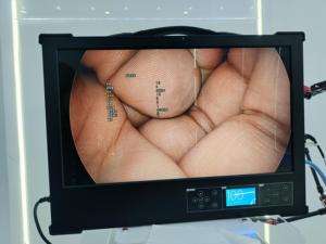 Xách tay nhỏ mini tích hợp nội soi Hệ thống camera cho Ent nội soi hysteroscope ureteroscope fiberscope - Product Image 2