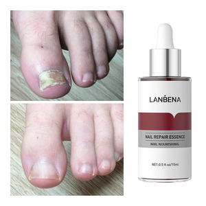 Suero Reparador de Uñas Antihongos LANBENA, Líquido Fortalecedor para Uñas Dañadas, Cuidado de los Pies, 0.5 Fl oz - Product Image 5