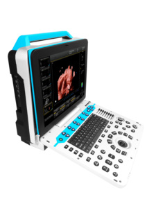 Daiwei DW-P30, Ecógrafo Doppler Color para Animales Veterinarios, Venta al por Mayor en China, con Aparato de Diagnóstico Ultrasónico 3D/4D/5D de 15 Pulgadas - Product Image 2