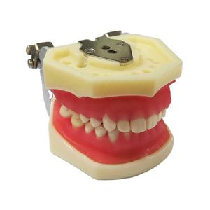 Modelo de Enfermedades gingivales Modelo de dientes de enfermedad de encías dentales - Product Image 2