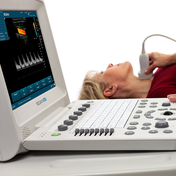 Sistema de diagnóstico de diagnóstico de Fábrica Edan U50 color gotero médico ultrasonido