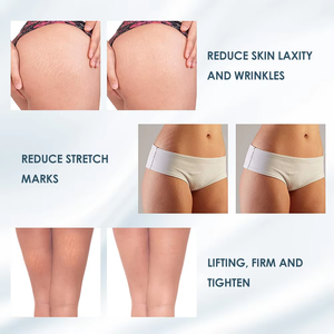 Eliminación <span class=keywords><strong>de</strong></span> arrugas, máquina adelgazante para quemar grasa, máquina adelgazante para el cuidado femenino, máquina antiarrugas - Product Image 5