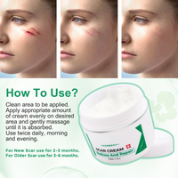 Crème personnalisée anti-acné et vergetures pour le visage et le corps, réparatrice des taches de rousseur et des cicatrices (chirurgie, blessures, brûlures, anciennes cicatrices)