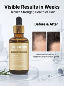 Huile Botanique Premium de Menthe Poivrée et de Gingembre, Sélectionnée à la Main, Texture Douce et Équilibrée, Soin Capillaire Haut de Gamme pour Cheveux et <span class=keywords><strong>Cuir</strong></span> <span class=keywords><strong>Chevelu</strong></span> - Product Image 6