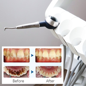 Prophy Mate N PMGN-PTL Pieza de mano dental para pulido con aire para limpieza y blanqueamiento dental - Product Image 2