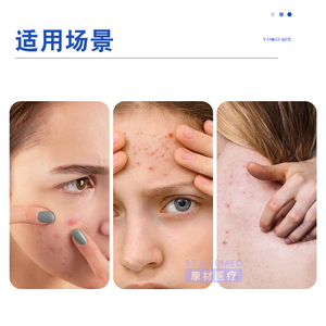 แผ่นแปะสิวหยุนหนานไป่เหยา ไฮโดรคอลลอยด์ สำหรับรักษาสิวบริเวณใบหน้า เกรดทางการแพทย์ 1 แพ็ค - Product Image 5