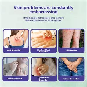 บาล์มบรรเทาอาการ<span class=keywords><strong>ผื่น</strong></span>คันจากสมุนไพรหลายชนิดครีมธรรมชาติไม่ระคายเคืองสำหรับ<span class=keywords><strong>ผื่น</strong></span>ที่ยุง<span class=keywords><strong>กัด</strong></span>แก้คัน - Product Image 2