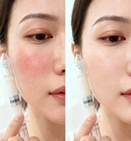 Sérum réparateur et régénérant pour la barrière cutanée Nano Skin, anti-rougeurs, crème réparatrice à la céramide pour le visage, soin post-intervention