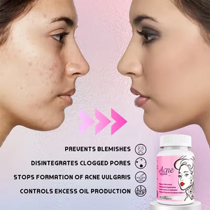 Suplemen Jerawat Populer Perawatan Kulit Kapsul Pembersih Jerawat Vegan Kapsul Jerawat untuk Kulit Berminyak Mencerahkan Kulit <span class=keywords><strong>Melanin</strong></span> Kapsul Pemutih Kulit - Product Image 5