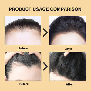 Private Label <strong>Wholesale</strong> Anti Hair Loss Organic Plant Extract Ginger Hair Shampoo and Conditioner Set for Hair - Product Image 4