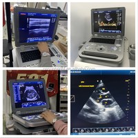 Alat USG Ekokardiografi Portabel 3D 4D Mesin Ultrasound Doppler Warna Berkualitas Tinggi