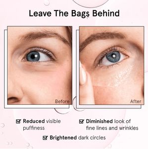 OEM/ODM Customized 3.5g Hyaluronic Acid <strong>Eye</strong> <strong>Cream</strong> &amp; Roller Serum Hydrate &amp; Reduce <strong>Eye</strong> <strong>Bags</strong> Private Label Available - Product Image 6