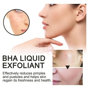 Sérum Visage Liquide à l'Extrait de Camélia, Glycérine et Acide Salicylique – Traitement Anti-Acné, Éclaircissant, Anti-Rides et Exfoliant pour Femmes, Tous Types de Peau - Product Image 6