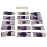 15Pcs Hematology Prepared Slides Blood Smear Prepared Slides