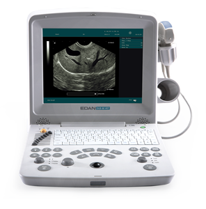 Échographe vétérinaire numérique Edan DUS 60 de haute qualité avec écran TFT-LCD 12,1 pouces pour hôpital - Product Image 3