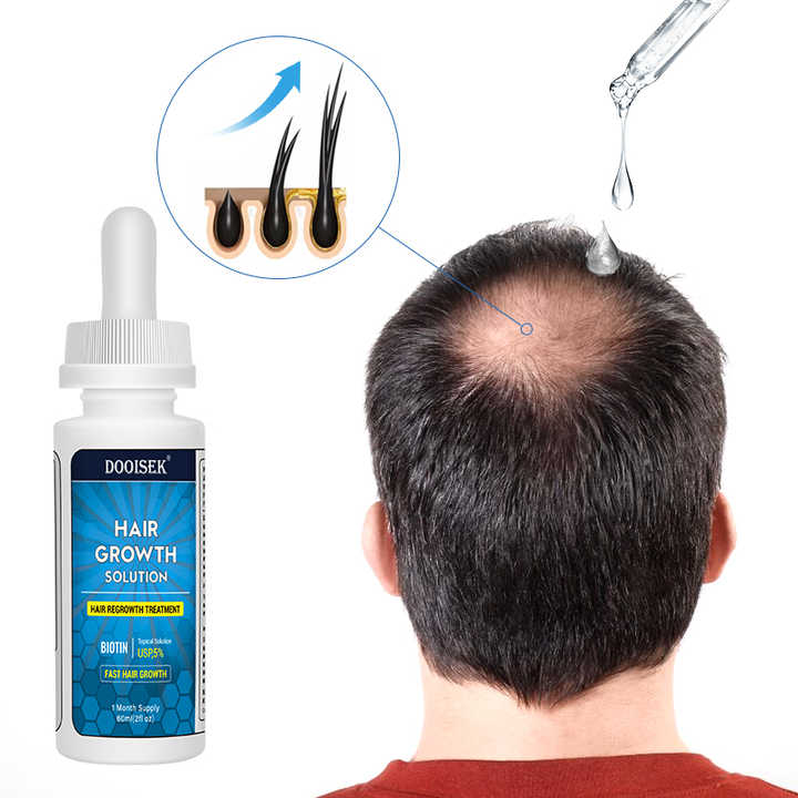 Men's Topical Solution Anti- Hair Loss Treatment Hair Regrowth Oil ...
