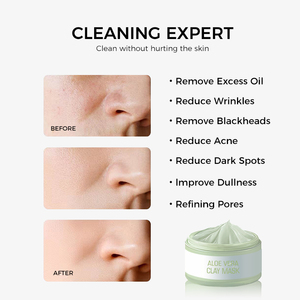 <span class=keywords><strong>Masque</strong></span> nettoyant premium 30g contre l'acné et les points noirs, <span class=keywords><strong>masque</strong></span> naturel à la boue de la mer Morte pour les peaux grasses, <span class=keywords><strong>masque</strong></span> purifiant en profondeur pour les pores - Product Image 4