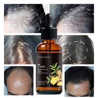 Meilleure qualité traitement de la perte de cheveux sérum prévention de la croissance des cheveux réparation du cuir chevelu croissance rapide gingembre croissance des cheveux huile essentielle