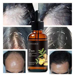 Suero <span class=keywords><strong>para</strong></span> <span class=keywords><strong>el</strong></span> <span class=keywords><strong>tratamiento</strong></span> de la pérdida de <span class=keywords><strong>cabello</strong></span> de la <span class=keywords><strong>mejor</strong></span> calidad, prevención del crecimiento del <span class=keywords><strong>cabello</strong></span>, reparación del cuero cabelludo, crecimiento rápido, aceite esencial de jengibre <span class=keywords><strong>para</strong></span> <span class=keywords><strong>el</strong></span> crecimiento del <span class=keywords><strong>cabello</strong></span> - Product Image 5