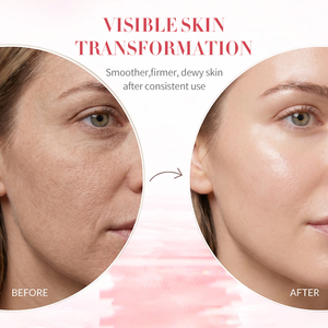 Produits de soin coréens en gros OEM, tonique hydratant pour le visage, hydratation intense, éclaircissement de la peau, à base de pétales de rose. - Product Image 4