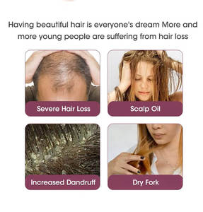 Yeni varış kırmızı soğan saç büyüme şampuan seti Oem Odm Anti saç dökülmesi soğan şampuan kabarık özel markalar için özellikler - Product Image 6