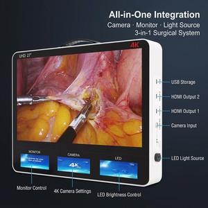 Sistema de Cámara Quirúrgica Portátil Todo en Uno Ocean 4K UHD con Pantalla Táctil, Grabador de Video, Laparoscopia, ORL, Artroscopia P 002 Ocean 4K U - Product Image 2
