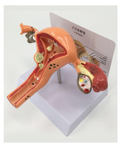 Scienza medica patologia utero modello di formazione allargamento utero modelli per la scuola di medicina - Product Image 5
