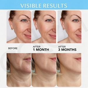Crème hydratante pour le visage <span class=keywords><strong>anti</strong></span>-âge Oalen Private Label, enrichie en rétinol, collagène, acide hyaluronique, raffermissante et hydratante pour le jour - Product Image 5