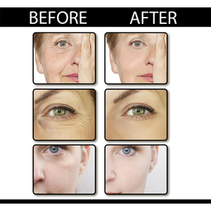 OUHOE retinol suero facial cuidado de la piel antienvejecimiento reafirmante hidratante pliegues nasolabiales estría <span class=keywords><strong>perioral</strong></span> suero eliminador para la cara - Product Image 4