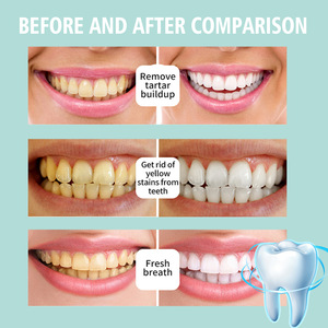 Mousse de limpieza profunda para dientes, eliminador de manchas de dientes con protección de dientes amarillos, ambientador refrescante para el <span class=keywords><strong>aliento</strong></span> - Product Image 5