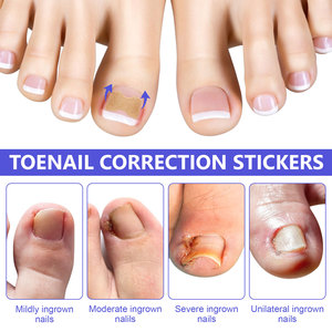 Parches Correctores <span class=keywords><strong>de</strong></span> <span class=keywords><strong>Uñas</strong></span> Encarnadas Transpirables con Logotipo Personalizado para el Tratamiento Profesional <span class=keywords><strong>de</strong></span> <span class=keywords><strong>las</strong></span> <span class=keywords><strong>Uñas</strong></span> Encarnadas y <span class=keywords><strong>Hongos</strong></span> en <span class=keywords><strong>las</strong></span> <span class=keywords><strong>Uñas</strong></span> - Product Image 3