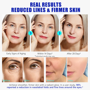 Grosir Label pribadi perawatan kulit wajah hidrasi mendalam Anti Penuaan Pengencang Kulit <span class=keywords><strong>Serum</strong></span> sel batang keriput untuk wajah - Product Image 4