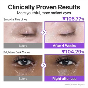Hydratant liquide pour les yeux, vegan et biologique, à marque privée, à l'acide hyaluronique, vitamine C, peptides et protéines, anti-âge et anti-rides - Product Image 4